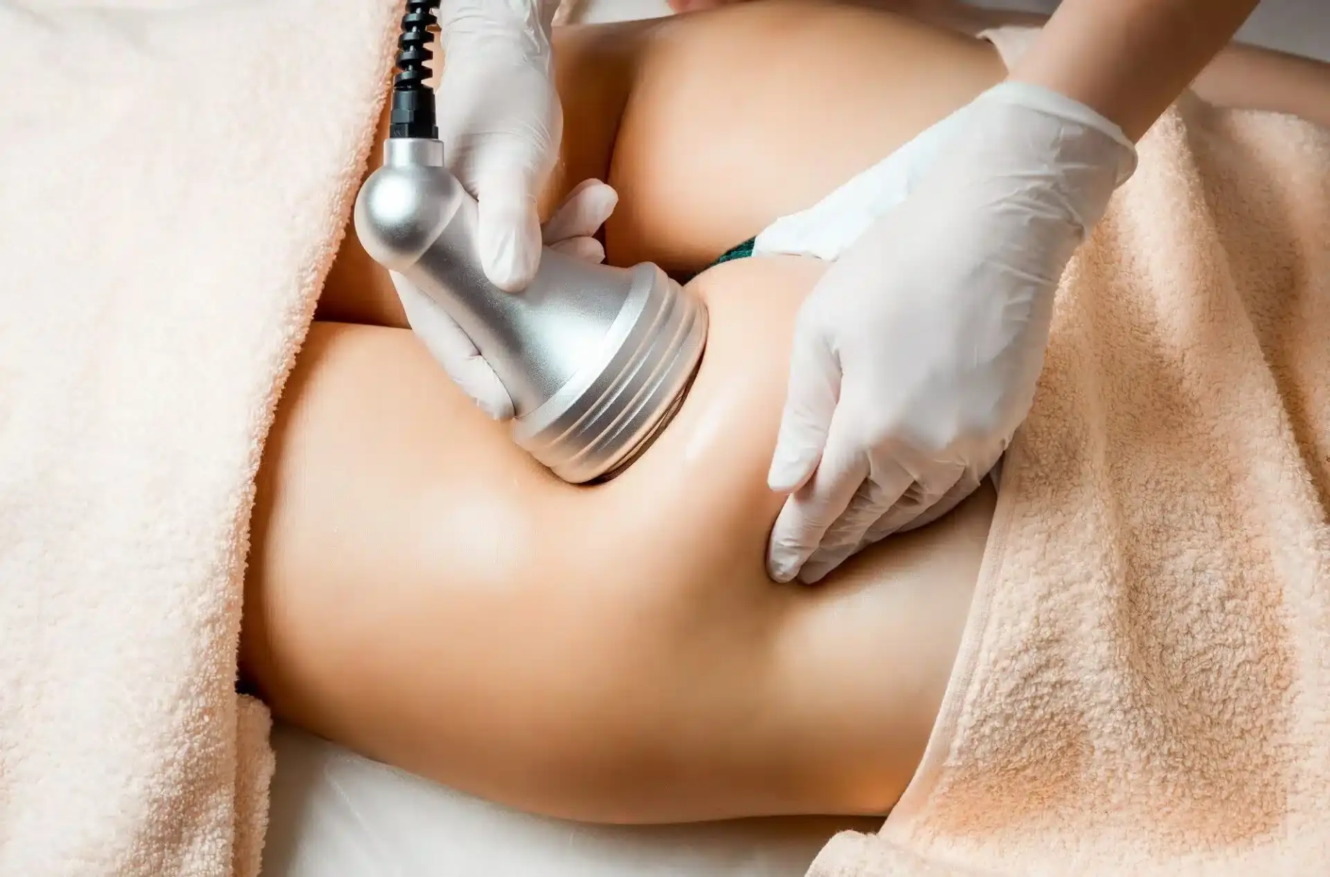 Tratamiento corporal con radiofrecuencia