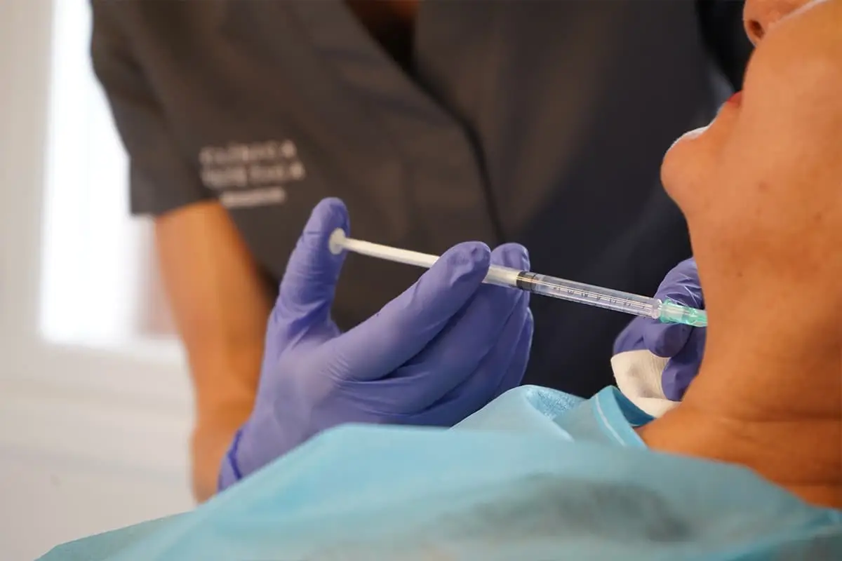 Tratamiento con microinyecciones en Clínica Estética Manacor