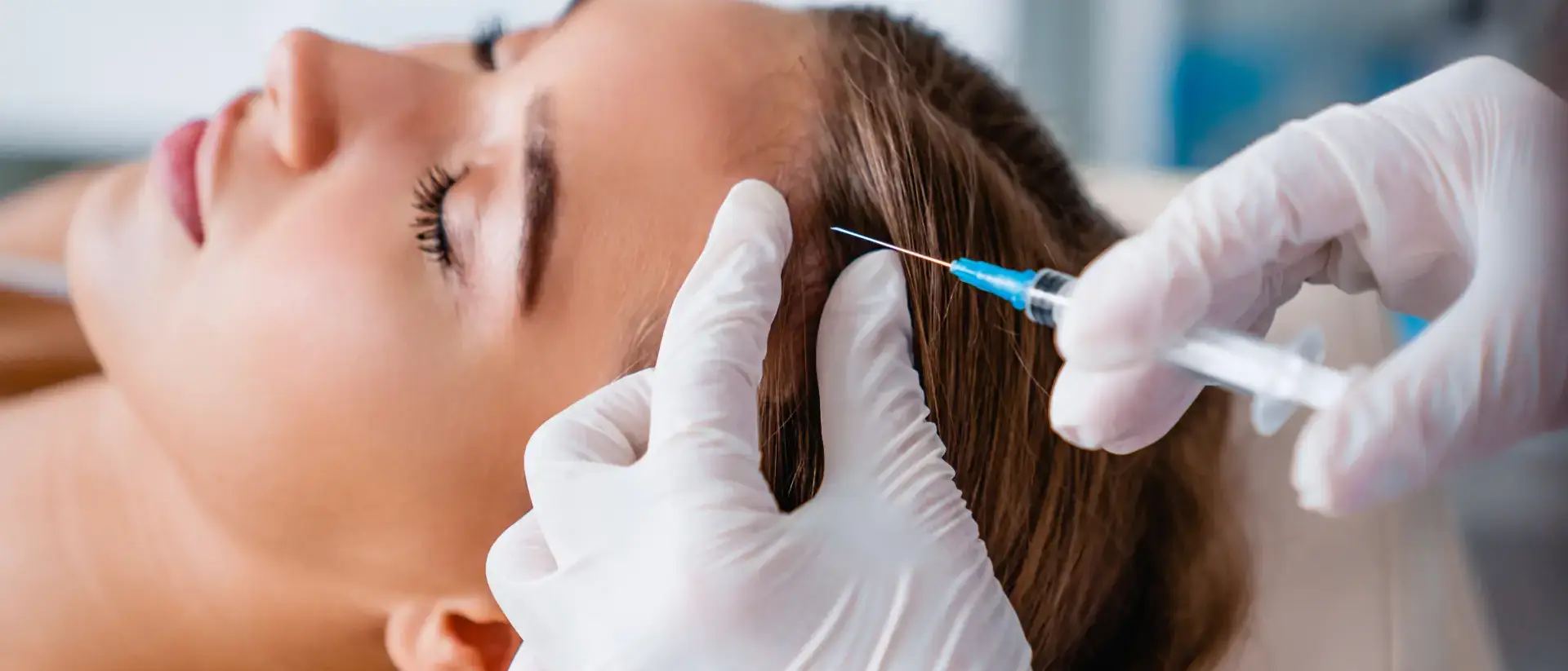 Mesotherapie wird auf die Kopfhaut aufgetragen