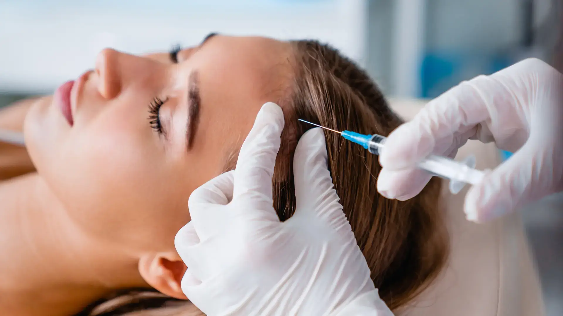 Aplicación de mesoterapia en el cuero cabelludo