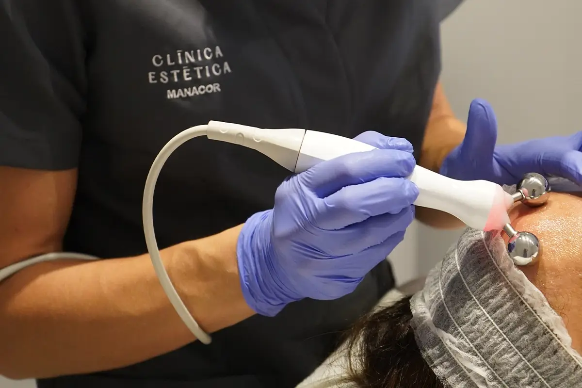 Tratamiento facial con aparatología en Clínica Estética Manacor
